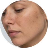 Korean skincare προϊόντα για δέρμα με τάση ακμής, κηλίδες, serums, καθαριστικά και toners.