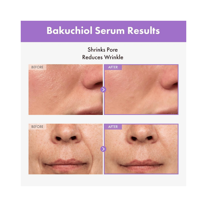 Eqqualberry Bakuchiol Plumping Serum πριν και μετά για εμφάνιση πόρων και λεπτών γραμμών